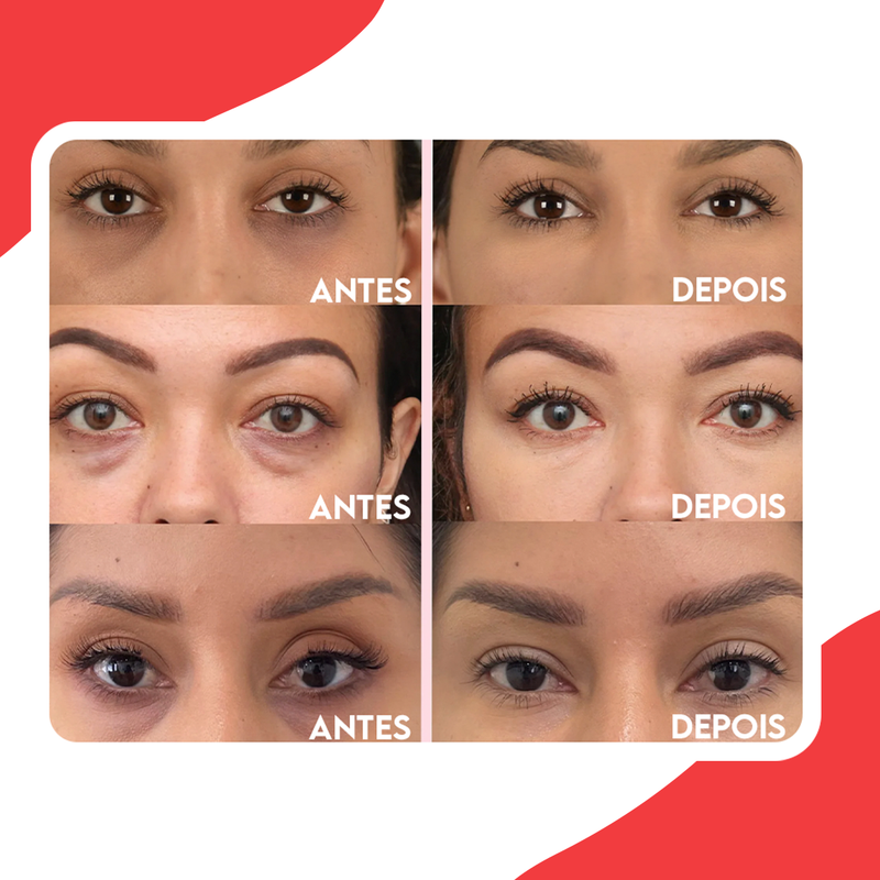 EyeRenew™ Removedor Poderoso de Olheiras